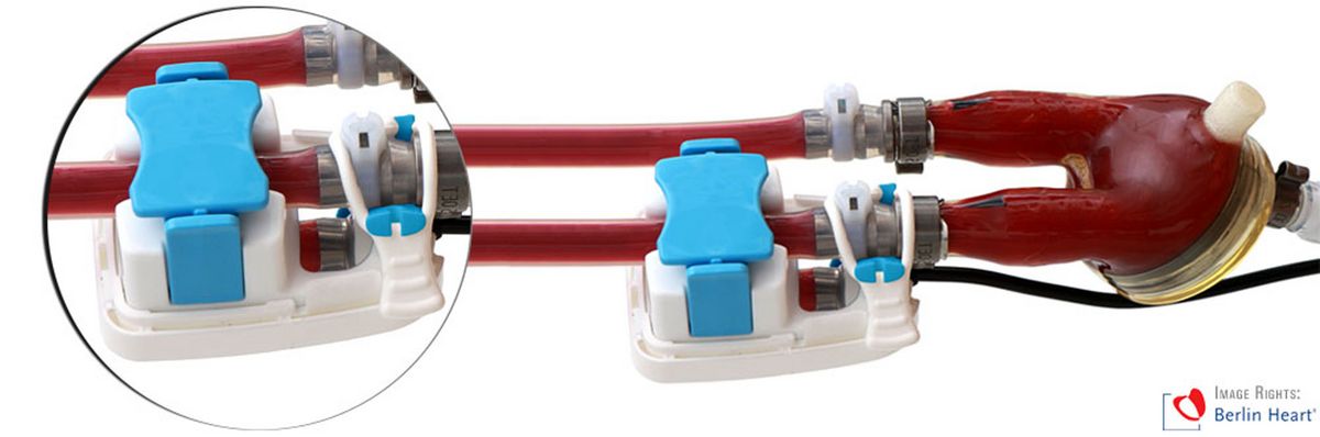 Kundenspezifischer SONOFLOW Clamp-On Sensor am Excor System der Firma Berlin Heart GmbH