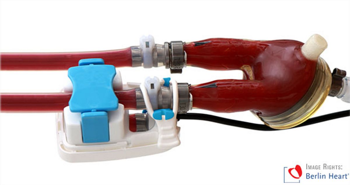Innovativer Strömungssensor für Herzunterstützungssystem