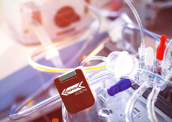 Nicht-invasive Flüssigkeitsüberwachung Tag der Organspender